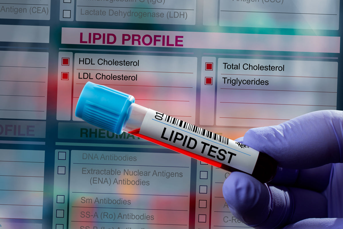 Tubo de laboratorio para prueba del perfil lipídico