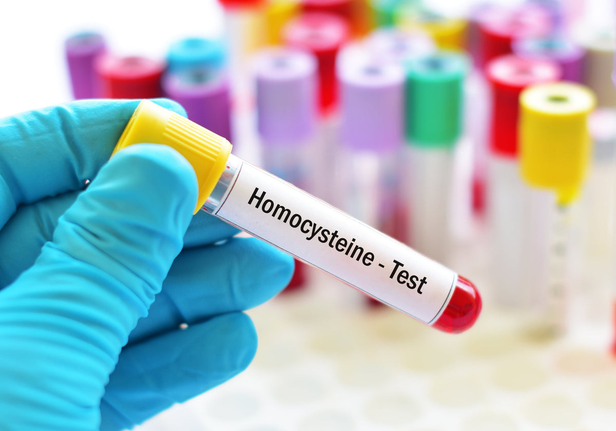 Tubo de laboratorio para prueba de la homocisteína
