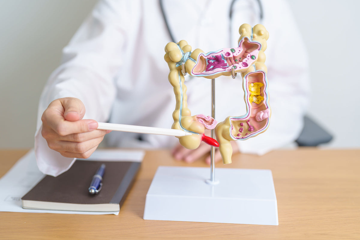 El cáncer colorrectal es un tipo de cáncer que afecta al colon y al recto, dependiendo de dónde se genere