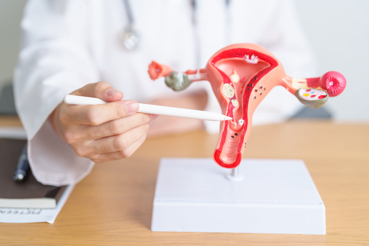 El cáncer de ovario afecta solo a las mujeres y puede generar complicaciones en todo su aparato reproductivo