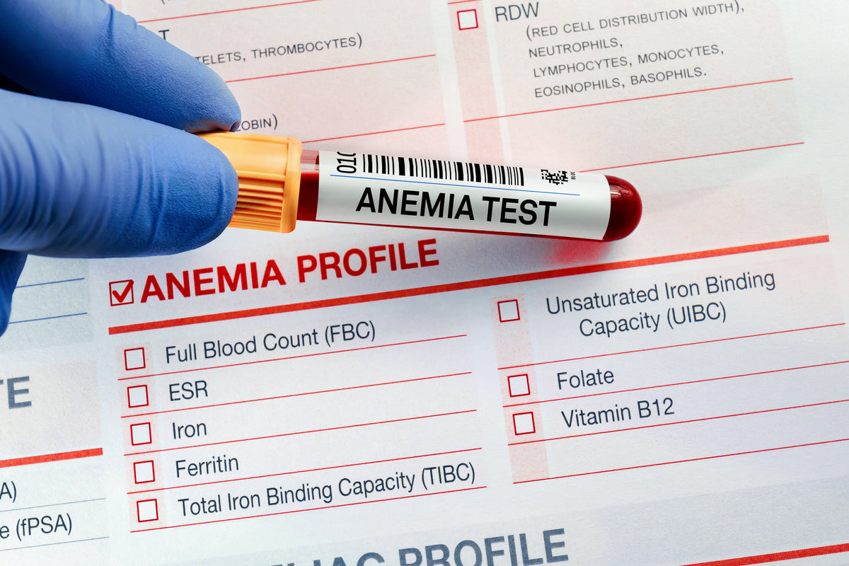 La anemia por deficiencia de vitamina B9 es una disminución de los glóbulos rojos producida por la deficiencia de la vitamina B9 (folato)