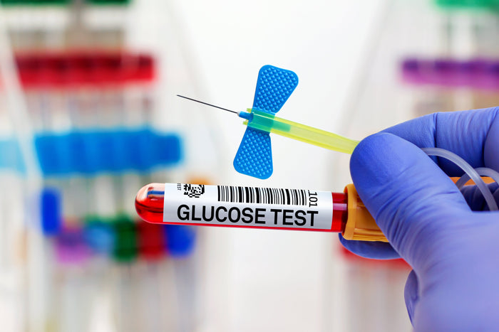 Tubo de laboratorio para prueba de la glucosa