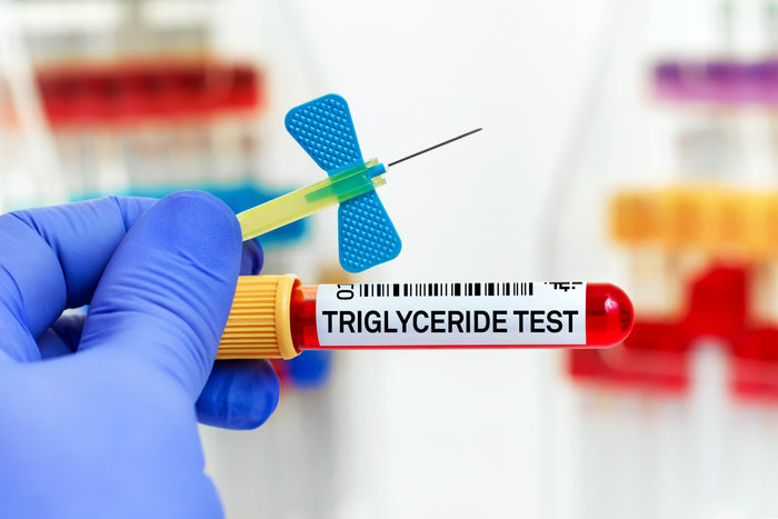 Tubo de laboratorio para prueba de los triglicéridos