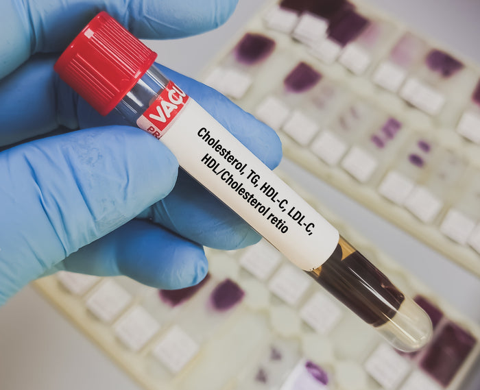 Tubo de laboratorio para prueba de esteroles y ácidos grasos