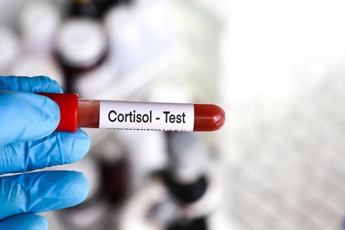 Tubo de sangre etiquetado con la palabra cortisol