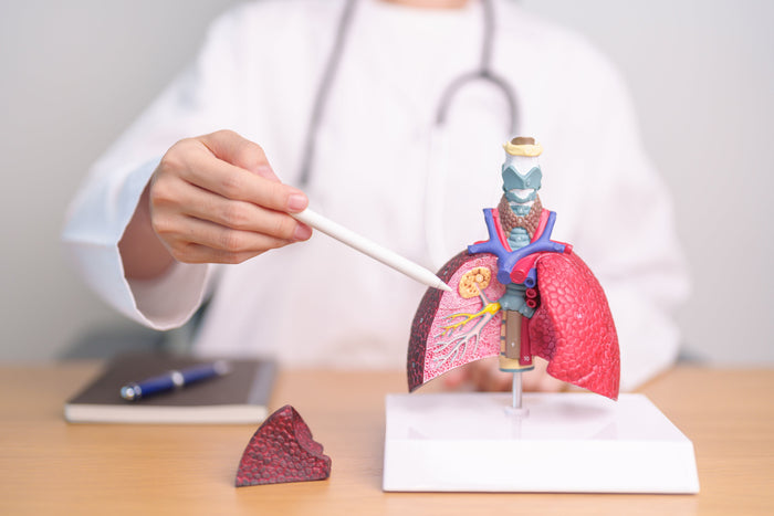 El cáncer de pulmón es un tipo de cáncer que se origina en los pulmones (dos órganos esponjosos que se encuentran dentro de la cavidad torácica y que absorben oxígeno cuando se inhala y liberan dióxido de carbono cuando se exhala)